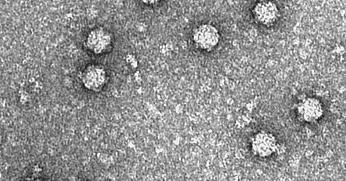 La IA cruzó una nueva frontera: ya diseñó virus capaces de reproducirse y matar bacterias